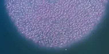 The Purple Bacteria That Are Afraid of Oxygen