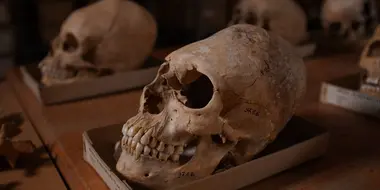 Riddle of the Roman Skulls