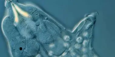 Looking at Tardigrade Sperm and Other Reproducing Swimmers