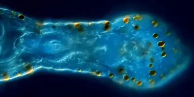 Aeolosoma: Polka-Dotted Vacuum Worms