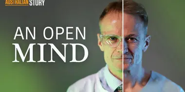 An Open Mind - Professor Richard Scolyer